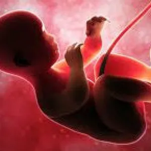 Aborto