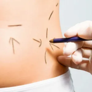 Cirurgia plástica