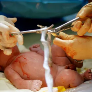 Cordão umbilical