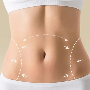 Lipoaspiração