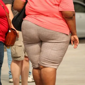 Obesidade