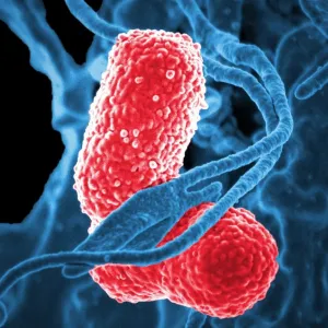 Pneumonia