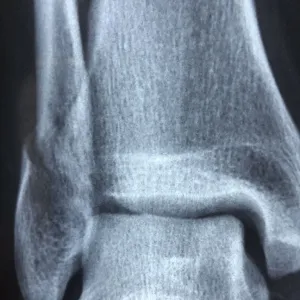 Radiografia